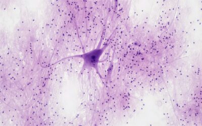 Neuroplasticità: fondamenti e implicazioni in fisioterapia